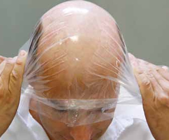 L'applicazione della membrana sulla cute, vista dall'alto